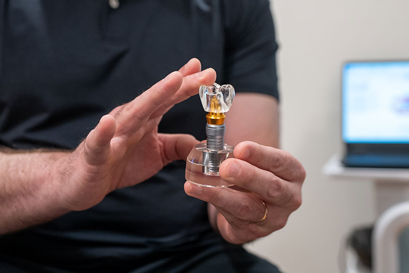 Dental Implants