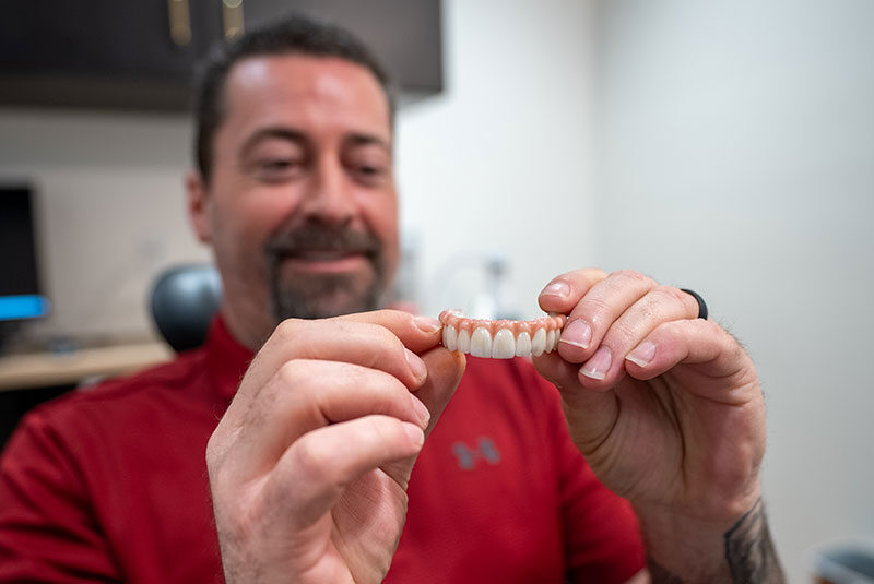 Full-Arch Dental Implants