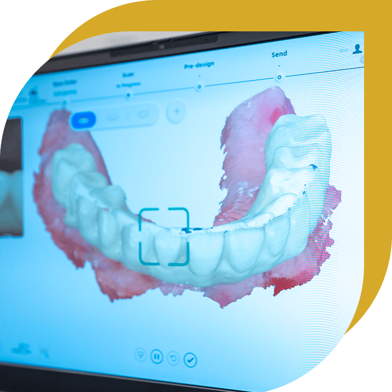 mouth being scanned