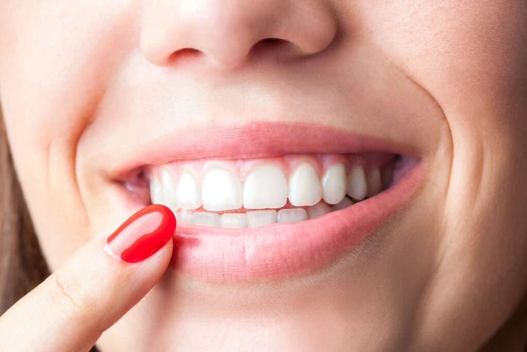 teeth whitening after